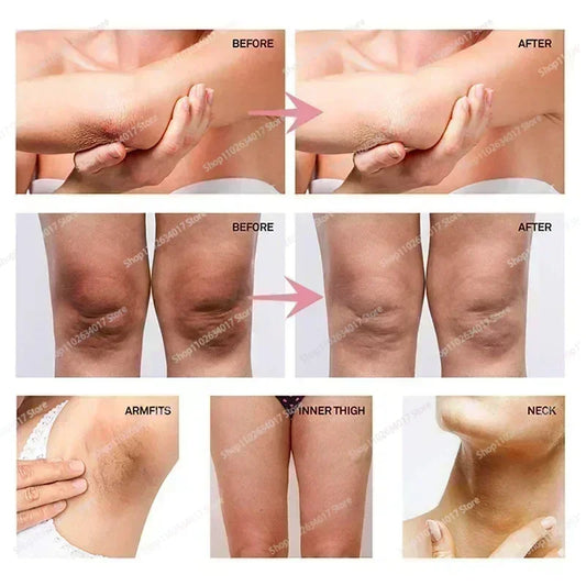 HOT~Whitening Cream Private Parts Underarm Bleaching Serum Whiten Butt Knee