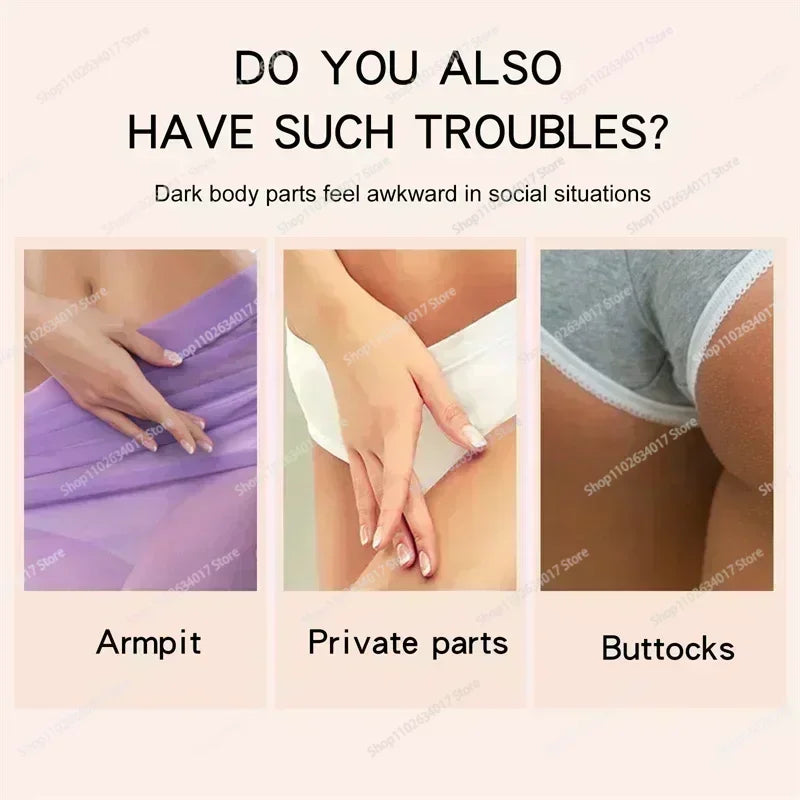 HOT~Whitening Cream Private Parts Underarm Bleaching Serum Whiten Butt Knee
