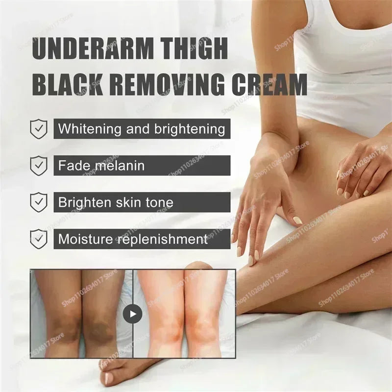 HOT~Whitening Cream Private Parts Underarm Bleaching Serum Whiten Butt Knee